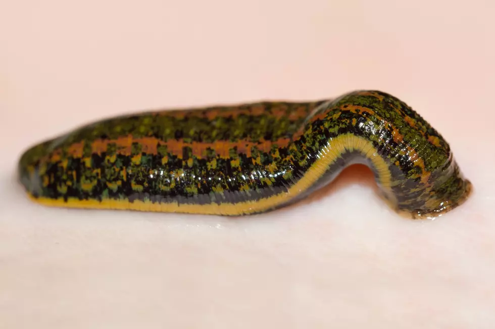 Massachusetts Has Bloodsucking Freshwater Leeches With Teeth